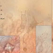 Attēlu rezultāti vaicājumam “Rimbachia neckerae”