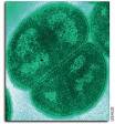 Deinococcus radiodurans