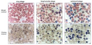 Attēlu rezultāti vaicājumam “Cribraria purpurea plasmodium”