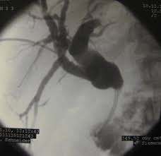 Image result for pthc