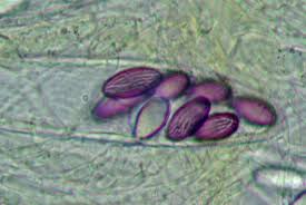 Attēlu rezultāti vaicājumam “Ascobolus furfuraceus”