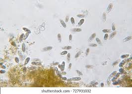 Attēlu rezultāti vaicājumam “Tranzschelia pruni-spinosae spores”