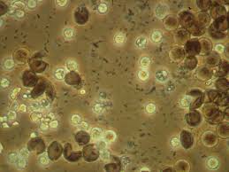 Attēlu rezultāti vaicājumam “Comatricha fragilis spores”