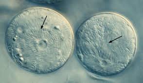 Attēlu rezultāti vaicājumam “Reticularia lobata plasmodium”