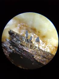 Attēlu rezultāti vaicājumam “Heterotrichia oerstedii (syn. Arcyria oerstedii) spores”