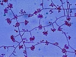 Attēlu rezultāti vaicājumam “Schistidium dupretii sporophyte”