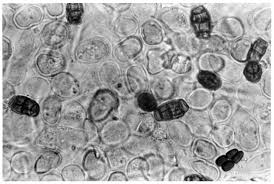 Attēlu rezultāti vaicājumam “Badhamiopsis praetermissa spores”