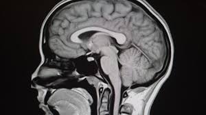 Image result for no brain