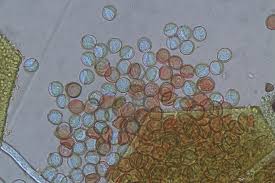 Attēlu rezultāti vaicājumam “Licea minima spores”