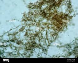 Attēlu rezultāti vaicājumam “Reticularia jurana”