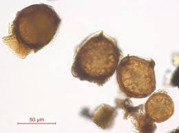 Attēlu rezultāti vaicājumam “Schistidium robustum sporophyte”