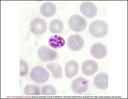 Attēlu rezultāti vaicājumam “Dianema depressum plasmodium”