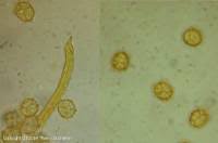 Attēlu rezultāti vaicājumam “Oligonema affine spores”