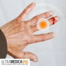 Znalezione obrazy dla zapytania palec