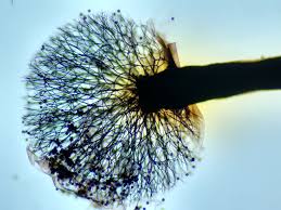 Attēlu rezultāti vaicājumam “Lamproderma echinosporum spores”