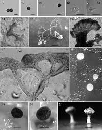 Attēlu rezultāti vaicājumam “Didymium squamulosum spores”