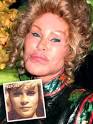 Bad plastic surgery: Jocelyn Wildenstein - bad-plastic-surgery_Jocelyn-Wildenstein