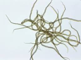 Attēlu rezultāti vaicājumam “Trichia contorta”