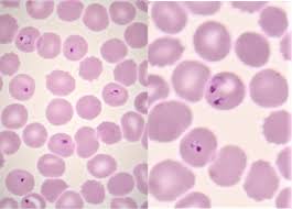 Attēlu rezultāti vaicājumam “Enteridium variabile plasmodium”