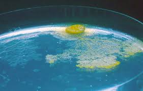 Attēlu rezultāti vaicājumam “Physarum pezizoideum spores”