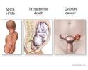 The New York Times > Health > Slide Show > Alpha Fetoprotein ...