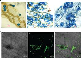 Attēlu rezultāti vaicājumam “Cribraria piriformis spores”