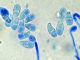 Attēlu rezultāti vaicājumam “Trichocolea tomentella sporophyte”
