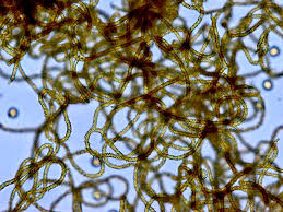 Attēlu rezultāti vaicājumam “Trichia erecta spores”