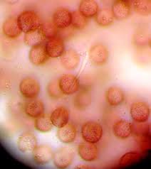 Attēlu rezultāti vaicājumam “Physarum orbis”