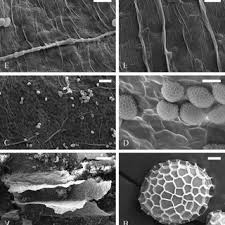 Attēlu rezultāti vaicājumam “Arcyria globosa”