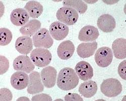 Attēlu rezultāti vaicājumam “Enteridium variabile plasmodium”