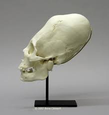Image result for elongated skulls