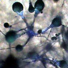 Attēlu rezultāti vaicājumam “Colloderma sp.”