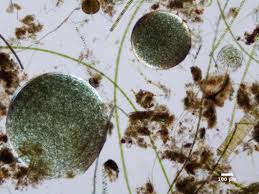 Attēlu rezultāti vaicājumam “Nostoc commune cells”