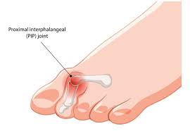 Znalezione obrazy dla zapytania palec