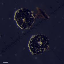 Attēlu rezultāti vaicājumam “Physarum luteolum spores”