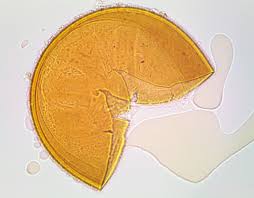 Attēlu rezultāti vaicājumam “Acaulon muticum sporophyte”