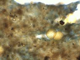 Attēlu rezultāti vaicājumam “Trichia scabra spores”