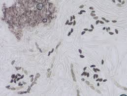 Attēlu rezultāti vaicājumam “Hypoxylon fragiforme / howeianum”