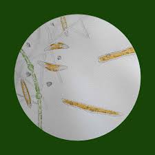 Attēlu rezultāti vaicājumam “Chara intermedia”