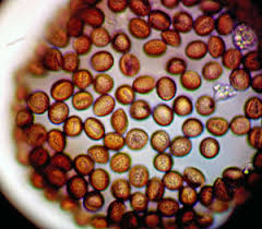 Attēlu rezultāti vaicājumam “Fuligo gyrosa spores”