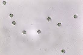 Attēlu rezultāti vaicājumam “Lycogala asperum”