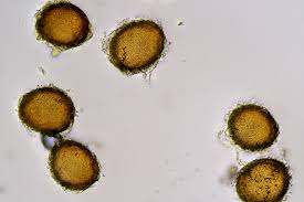 Attēlu rezultāti vaicājumam “Ephemerum serratum”