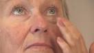 How To Get Rid Of Eye Bags (Caring For Your Eyes)