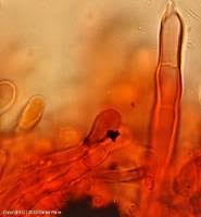 Attēlu rezultāti vaicājumam “Hyphodontia barba-jovis”