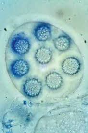 Attēlu rezultāti vaicājumam “Stemonitopsis amoena spores”