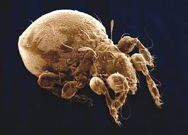 Attēlu rezultāti vaicājumam “Arachnida”