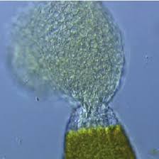 Attēlu rezultāti vaicājumam “Bryum pallens sporophyte”