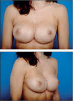 http://t0.gstatic.com/images?q=tbn:ANd9GcS1gQQJVUvUgJZAFWgHno1jwUqmUWyU94ablgvLk6lROgpW-7kn