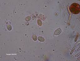 Attēlu rezultāti vaicājumam “Parmelina tiliacea”